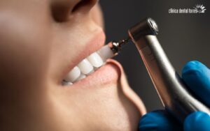 Limpieza dental Antequera