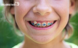 Dentista para niños Antequera