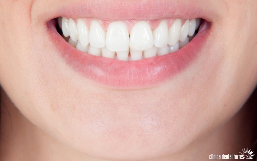 ¿Sabes cuál es la edad exacta en la que tus dientes empiezan a envejecer?